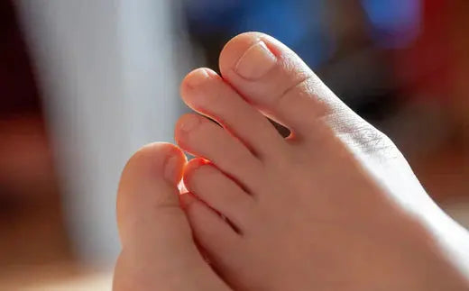 Toenail Regrowth: How DrLuigi® Medical Slippers Support Faster Recovery DrLuigi