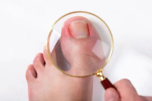 When to Ask Your Podiatrist for Help and How to Cut Your Toenails DrLuigi