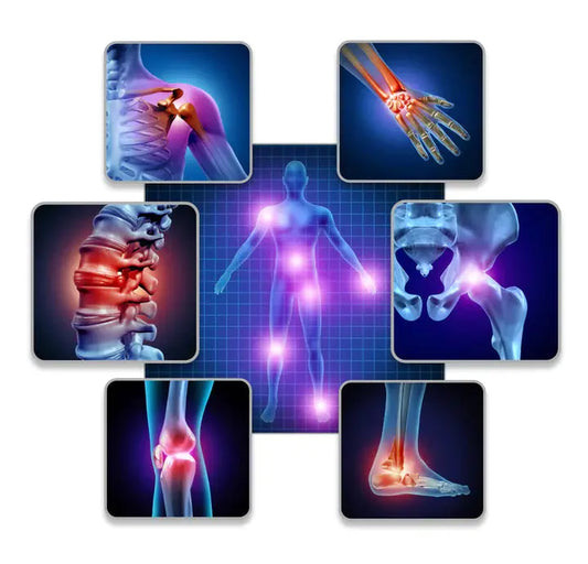 What is Psoriatic Arthritis? DrLuigi