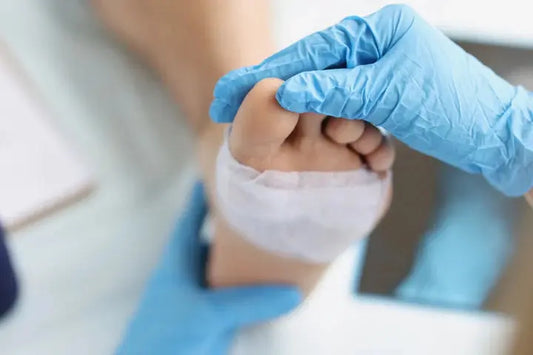 How to Care for Common Foot Wounds DrLuigi