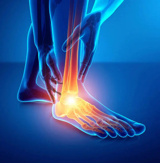 Painful Toes It Could Be Capsulitis DrLuigi